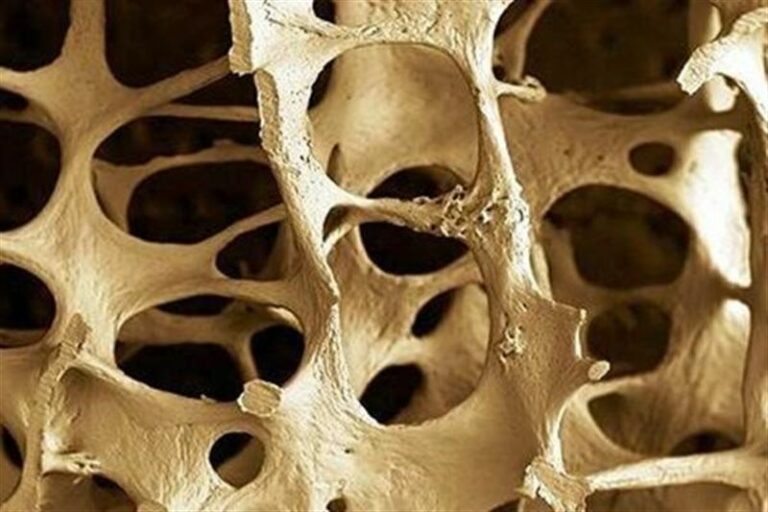 Un farmacéutico albaceteño realiza con éxito un programa de detección precoz de osteoporosis en su farmacia