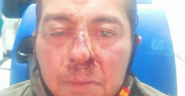 Denuncian una brutal agresión a un chico trans en Toledo