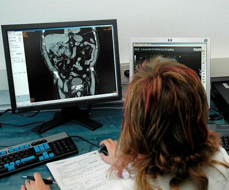 El Sescam invierte en IA para mejorar la Red de Imagen Digital