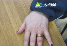 Vídeo: Así ayudaron los bomberos de Tomelloso a retirar dos anillos de un dedo inflamado