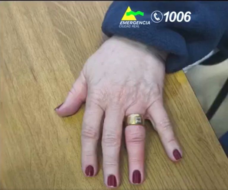 Vídeo: Así ayudaron los bomberos de Tomelloso a retirar dos anillos de un dedo inflamado