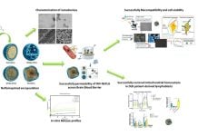La UCLM abre una nueva vía para combatir la demencia con cuerpos de Lewy gracias a la nanotecnología